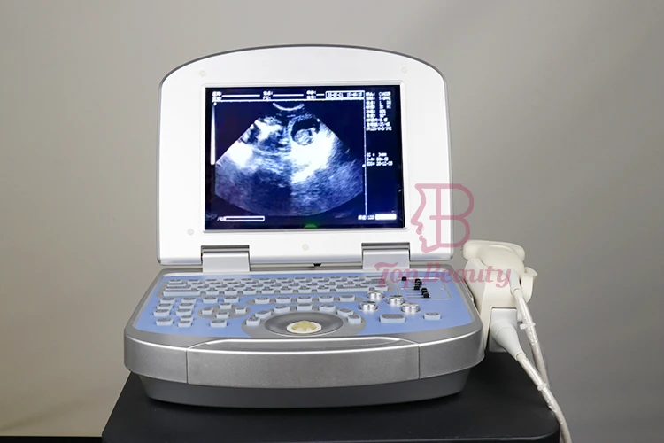 Portable Site-rite Ultrasound Scan 3D 4D Full Digital Medical Ultrasonido Portatil Hospital Diagnostic Laptop Machine