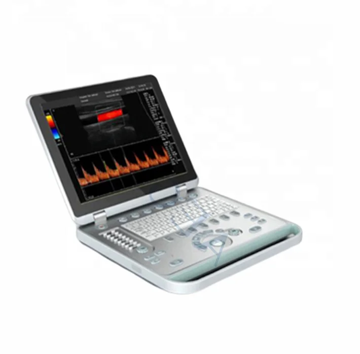 High quality machine color doppler ultrasound ultrasound machine color doppler ultrasound color doppler laptop