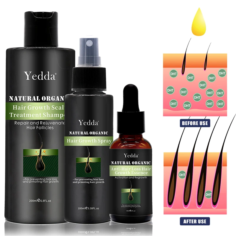 Ginseng Extract Anti-hair Loss Hair Regrowth Spray Private Label Plant Extract Shampoo