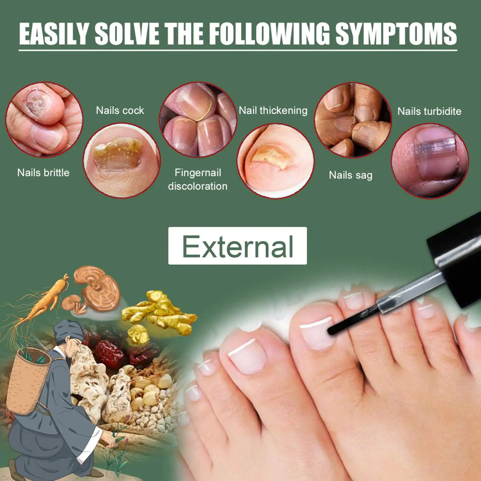 Costom Nail Repair Liquid Solution Fungal Nail Antifungal Anti Fungus Toe Nail Care Hand and Foot Onychomycosis Care