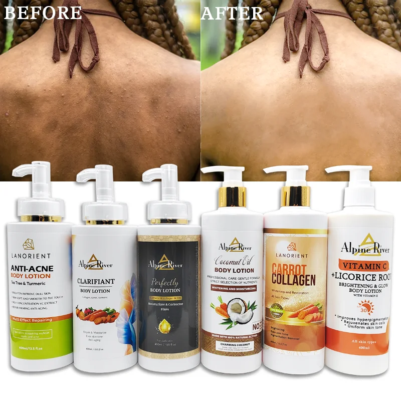 Natural Organic Vitamin E Face & Body Moisturizing Lotion Carotene Removing Dark Spots Brightening And Whitening Body Lotion