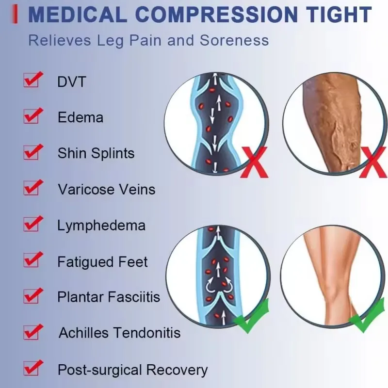 Anti Varicose Veins Stockings 20-30 Mmhg Medical Compression Socks For Women Circulation Medical Compression Socks