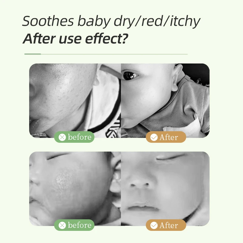 Aiyu китайский натуральный травяной крем для ухода за кожей для детей и младенцев