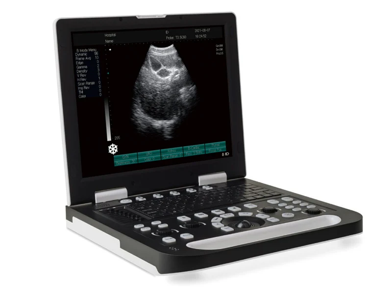 Полный цифровой ноутбук ультразвуковой сканер SS-10