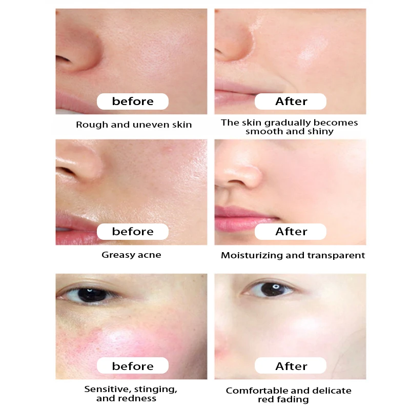 2024 New OEM ODM Korean Skin Care Products Organic Face Moisturizing Hydrating Repair Rice skincare Facial Rice Skin Care Set
