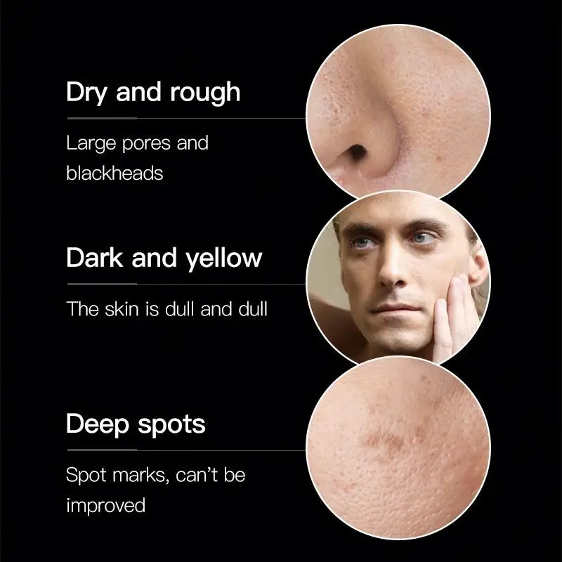 Private Label Mens Skincare Products Acne Treatment Repair Moisturizing Oil Control Skin Care Set for Men Face