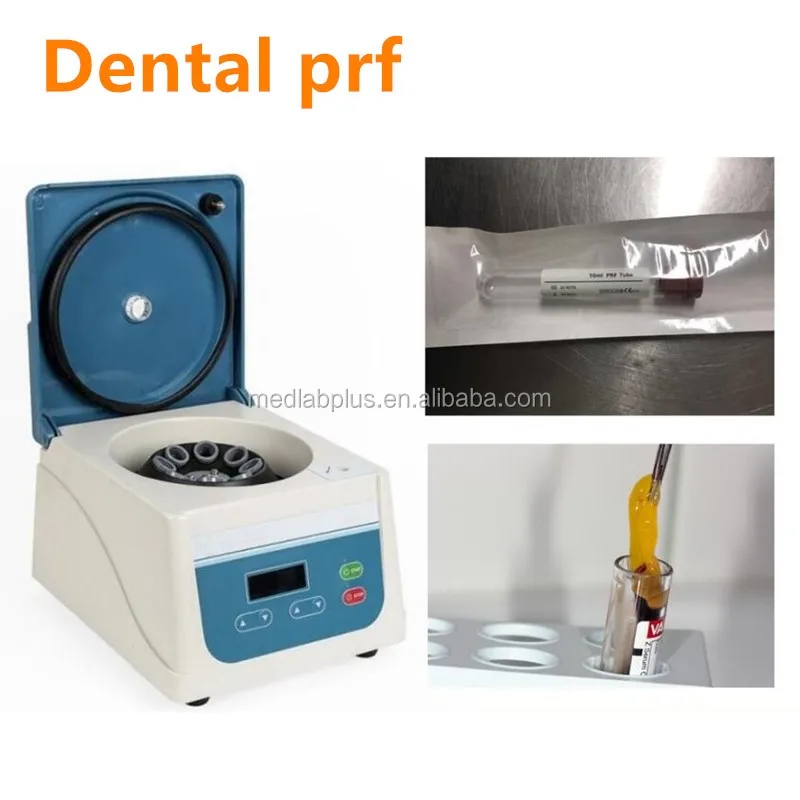 prf centrifuge dental