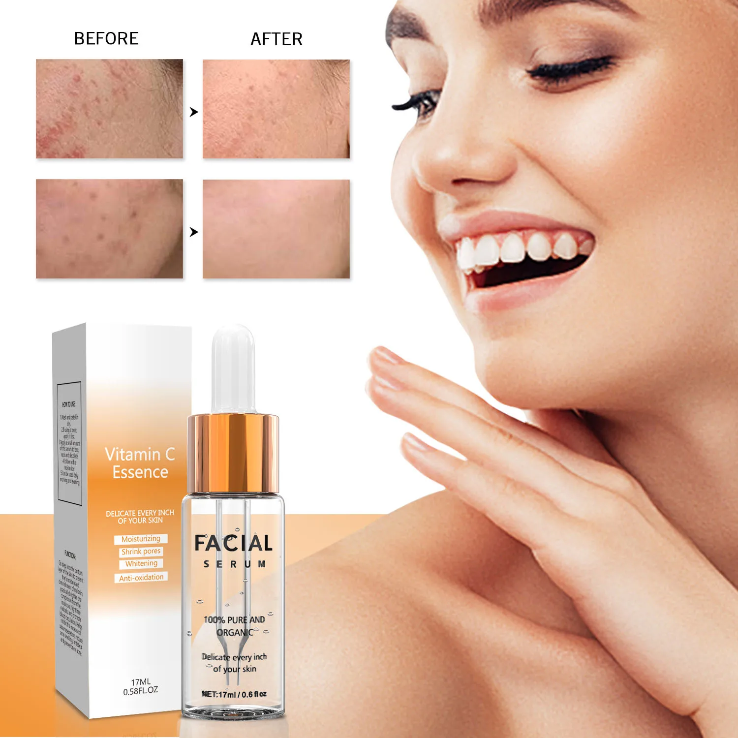 Ascorbic Acid 8% Alpha Arbutin 2% Hyaluronic Acid Remove Yellow Fad Acne Print Hydrating Moisturizing Essence 30ml