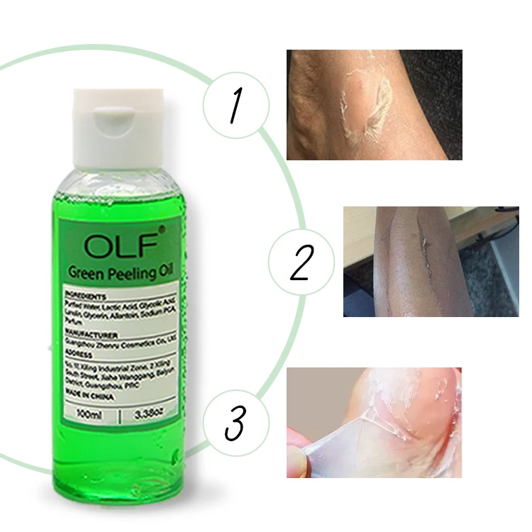 Private label skin care peeling oil foot peel yellow peeling oil whitening