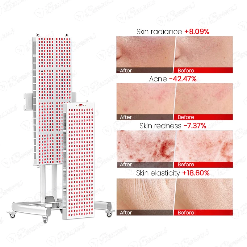 Red Skin Led Physical Therapy 660Nm 850Nm Pain Relief Device Anti Aging Head And Face Panel Lamp Light For Face Neck Pain Reli