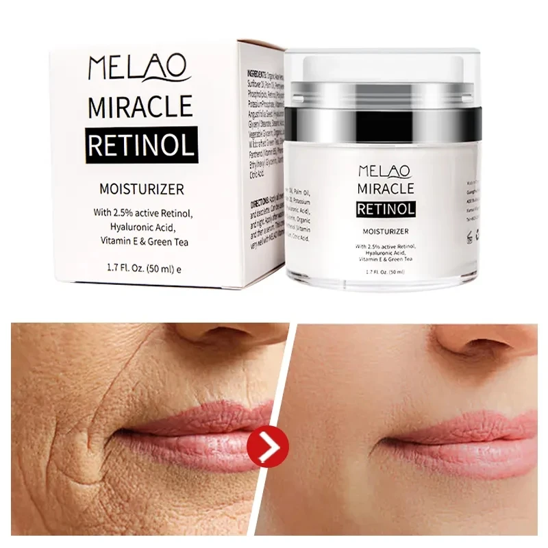 Wholesale Organic Facial Skin Care Revitalizer Moisturizer Face Lift Cream Hyaluronic Acid Anti Aging Retinol Face Cream