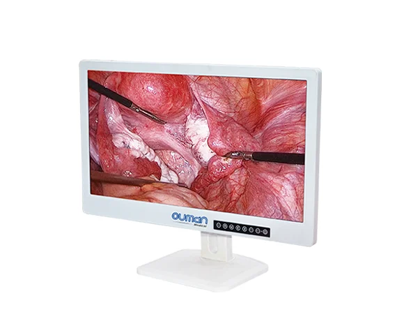 Made In China Minimal Invasive Surgery Medical Endoscope  Monitor