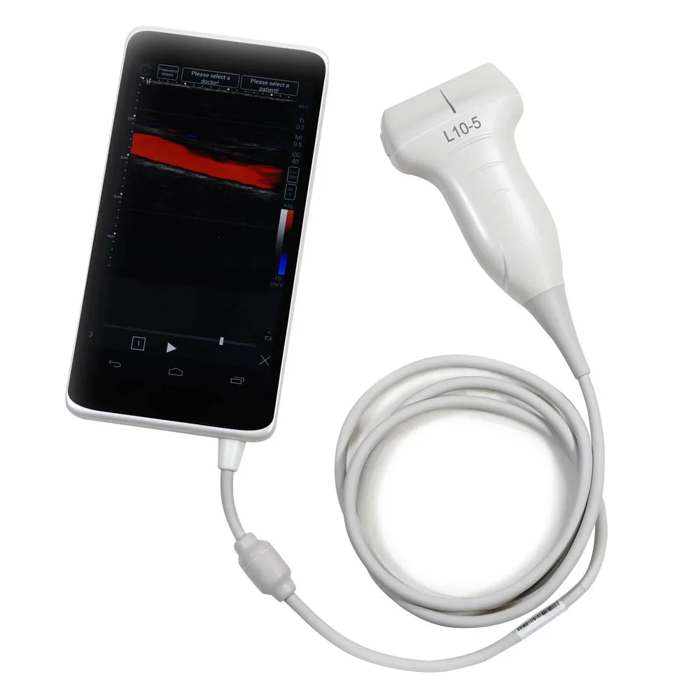 2022 Handheld  Color Linear Ultrasound Scanner Linear Probe wireless colour doppler linear ultrasound probe