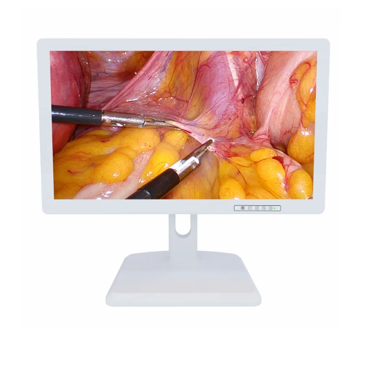 Белый медицинский ЖК-монитор для всех эндоскопических хирургических целей