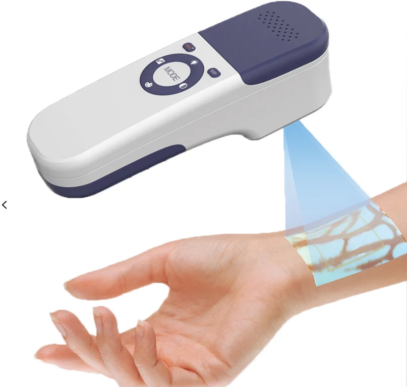 Wholesale Cheapest Portable Medical Infrared Vein Finder Machine For Hospital Use