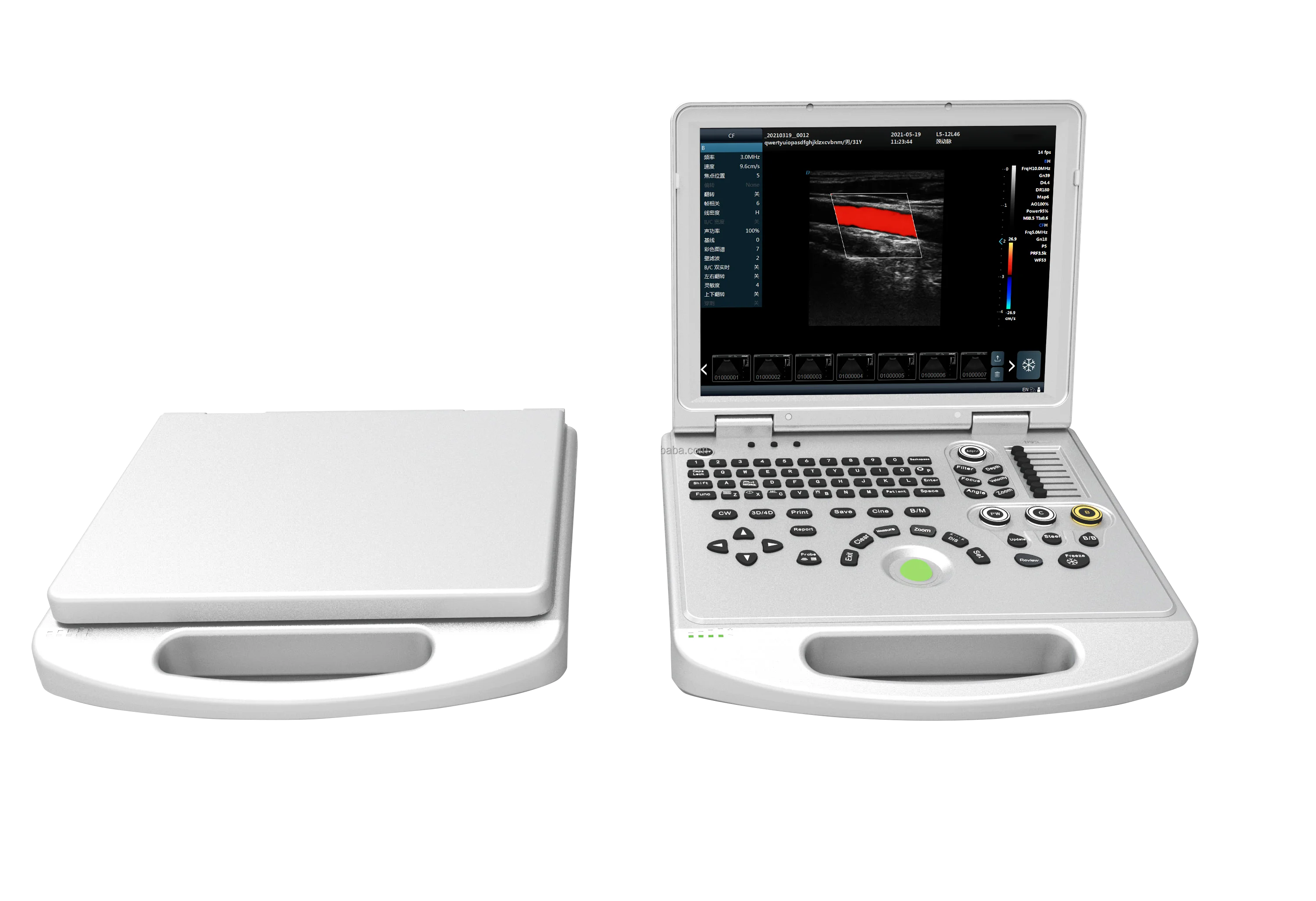 CE ISO сертифицированный OEM Заводская цена портативный полноцветный допплер ультразвуковой аппарат сканер 3/4/5D диагностическая система