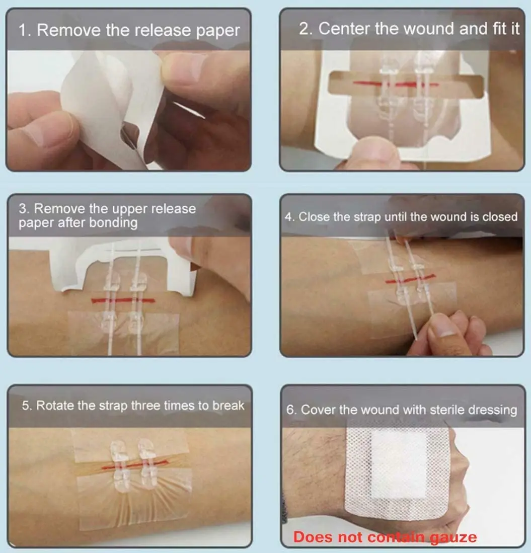 2 Pcs A Box Emergency Wound Closures band-aid Adhesive Bandages, Zip Stitch Stickers band-aid