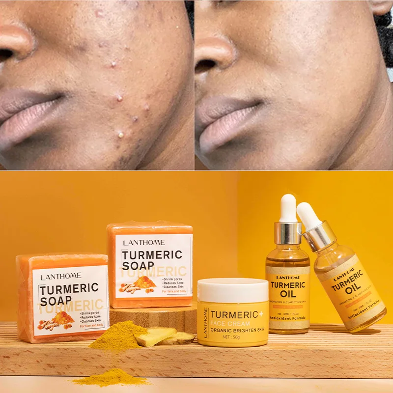 Wholesale Handmade Turmeric Shower Bath Soap Skin Whitening Lightening Anti Acne Deep Cleansing Bleaching Kojic Acid Face Soap