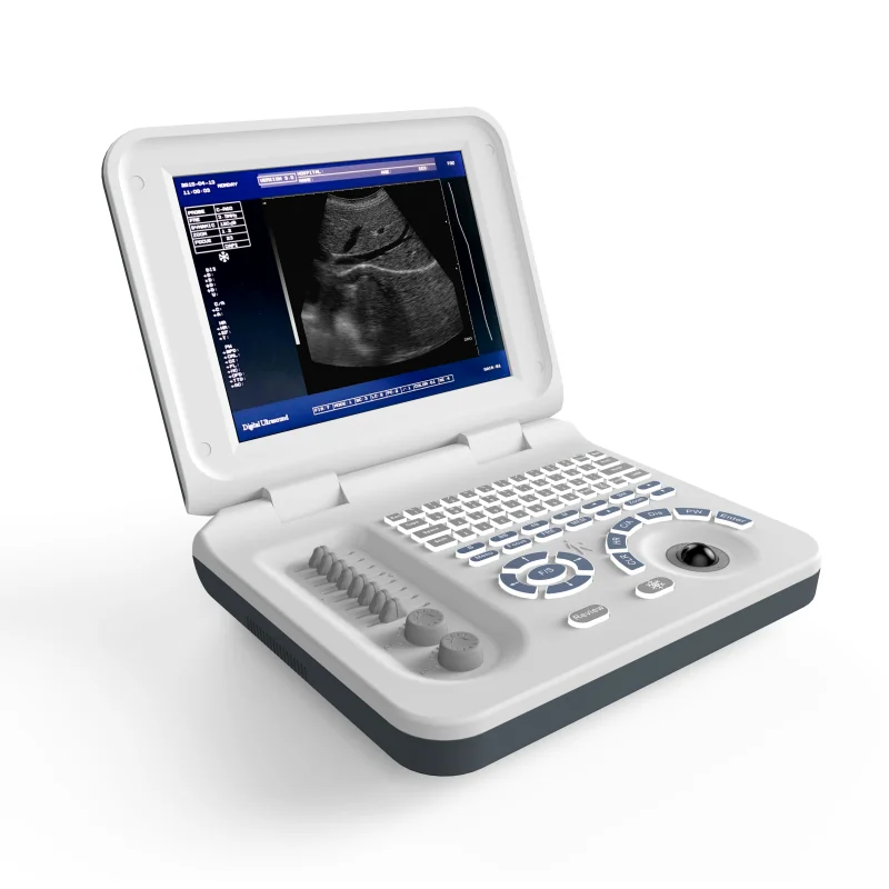 China Supplier Vet & Human Use Pc Platform B/W Full Digital Ultra Sound Scan Ultrasound Machine
