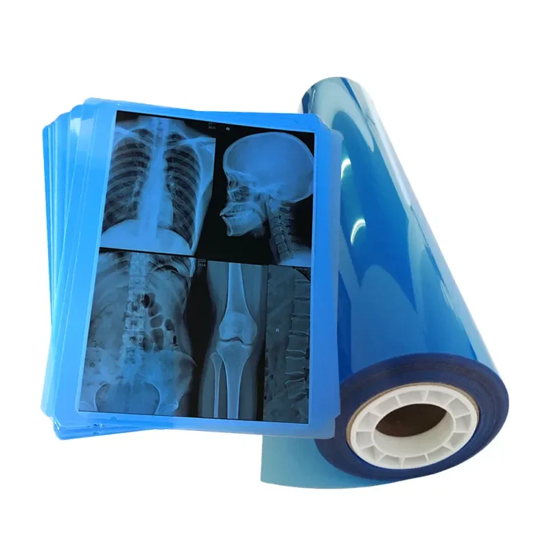 Inkjet Blue Medical dry film transparent blue xray film for CT DR MRI Radiological device