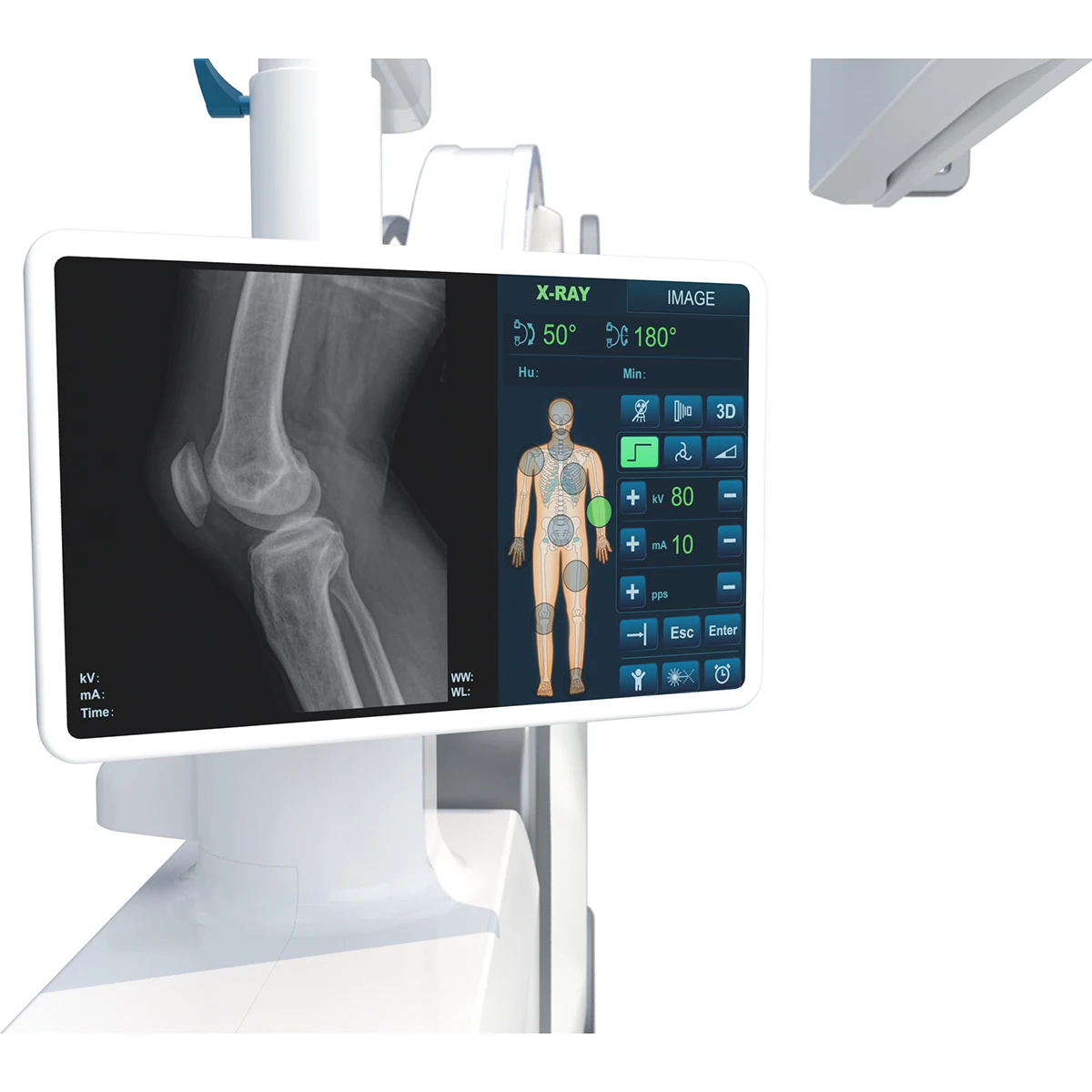 Medical Mobile 5kW HF Digital 3D C arm X Ray Machine for Orthopedics Surgery