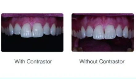 Soft Silicone Sealed Dental photography Contrastor Oral Photographic Background