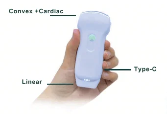 ultrasound scan machine with all the probes portable ultrasound with vascular and echo probe