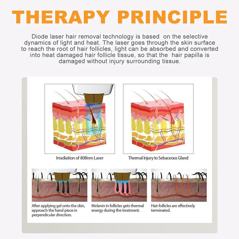 2021 New Uv Effective Diode Laser Hair Removal 755 808 1064 Depilacion Laser diode With Big Discount