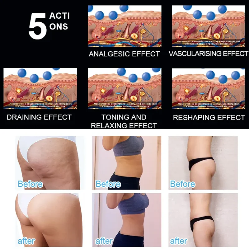 Factory Cellulite Reduction Body Contouring Lymphatic drainage therapy 360 Rotating 8d Slim Inner Ball Roller Machine endosfera