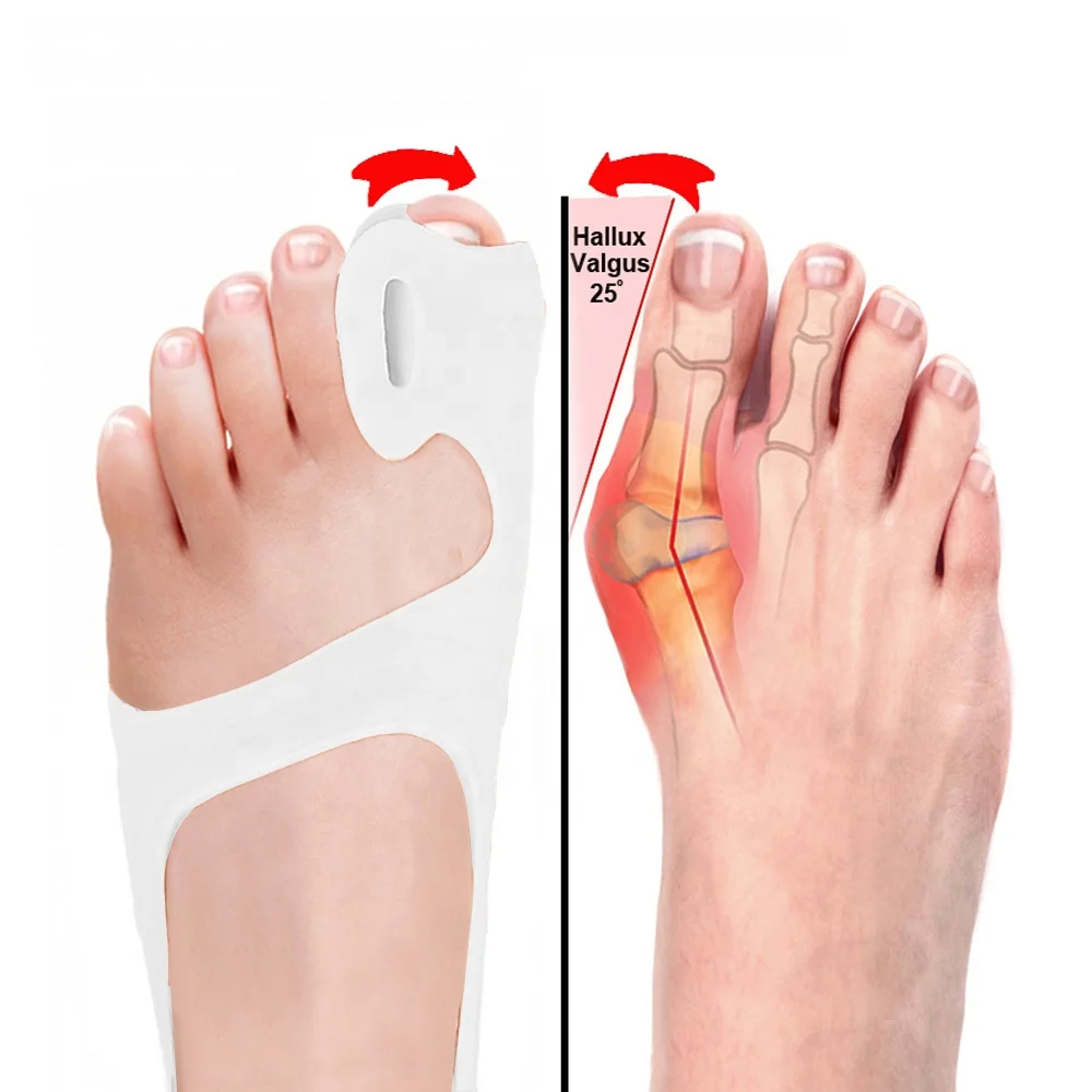 Toe Separator Big Toe Straightener Toe Alignment Bunion Corrector Ingrown Toenails Protector Overlapping Hallux Valgus Corrector