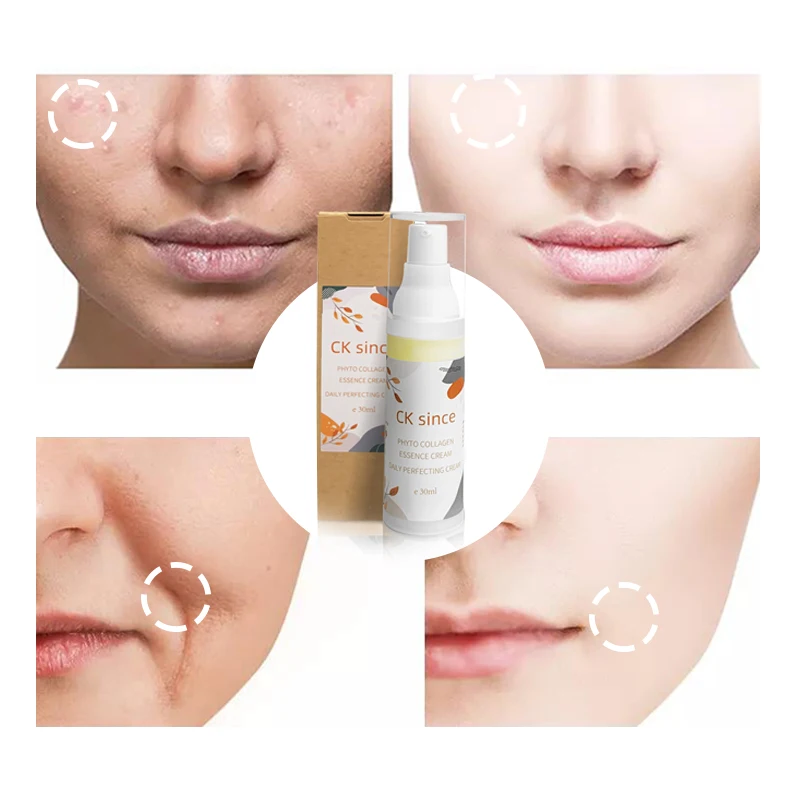 Free Sample Women skin care beauty products bleaching body  face cream lotion skin whitening cream for dark skin