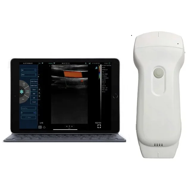MC27 Lowest price portable pocket wireless and USB ultrasound probe scanner 3 in 1for September promotion