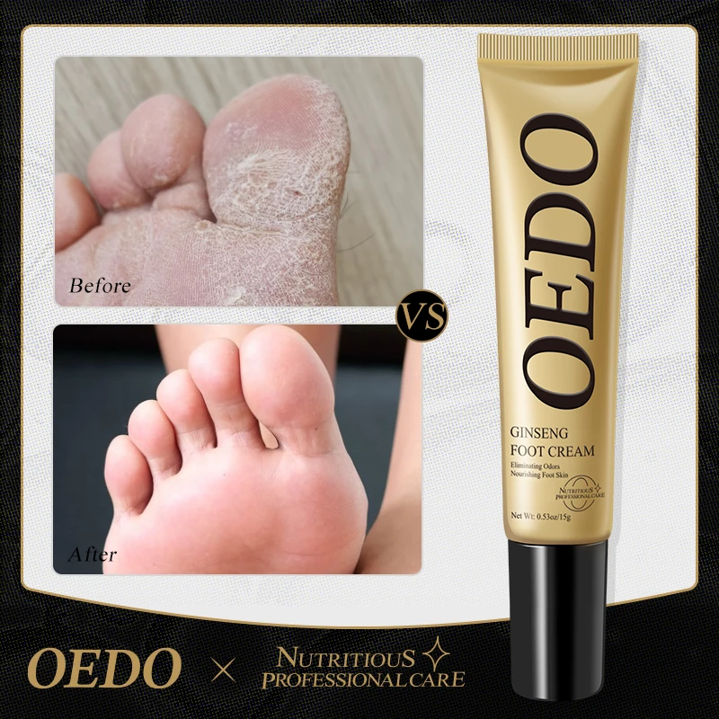 Herbal Nail Treatment Cream Anti-fungal  Dressing Ointment Onychomycosis Paronychia Nail Infection Nail Fungus Treatment