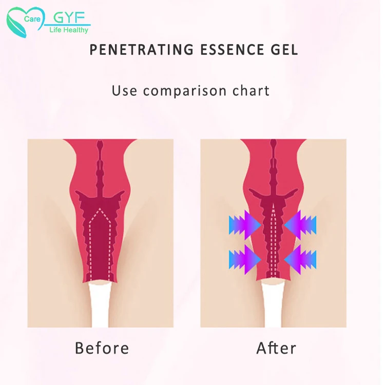 female antibacterial contraception gel