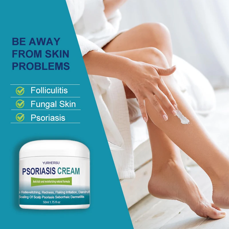 High Quality Natural Skin Care Treatment Psoriasis Eczema Herbal Cream