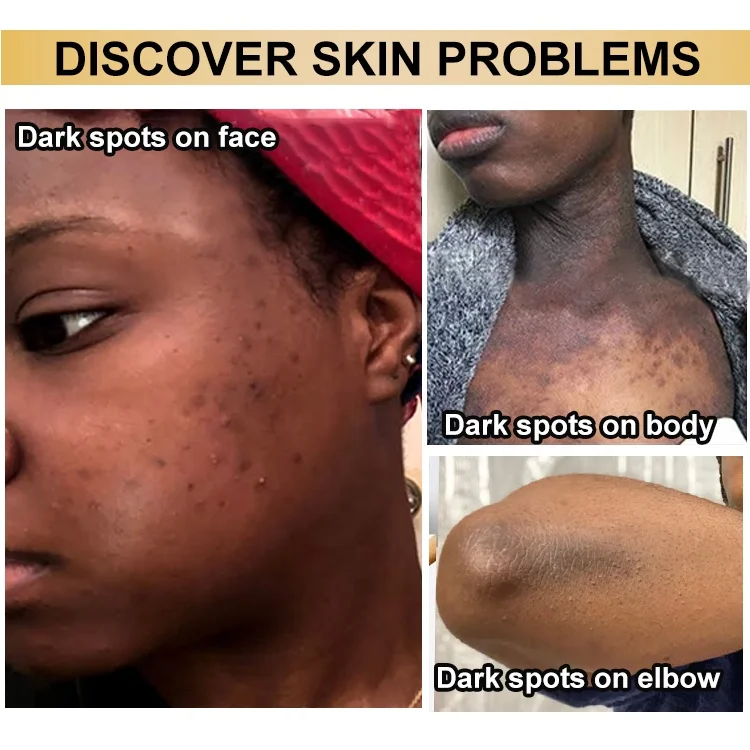 Anti Aging Skincare Set Hyaluronic Acid Skin Care Set Whitening Retinol Set Skin Care