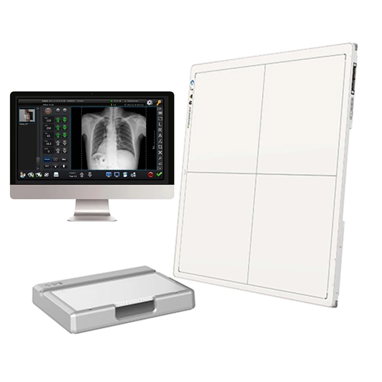 Hot selling Flat Panel X ray flat Panel Wireless 1717 Flat Panel Detector For Human/veterinary Use