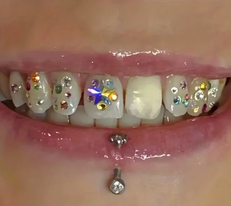 Wholesale Solid opal Tooth Gem