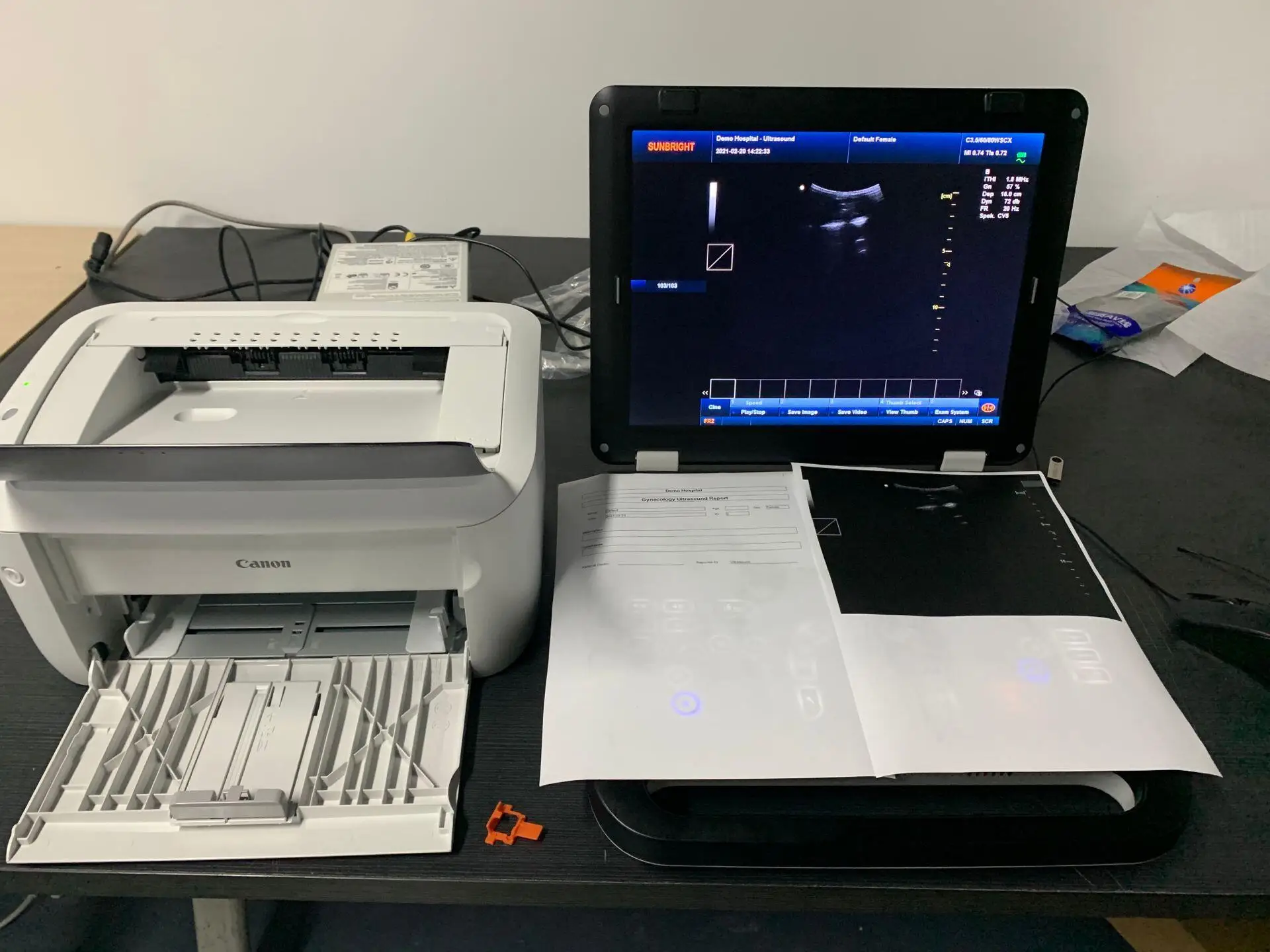 2 set software human and animal use Laptop Ultrasound Scanner Machine with probe