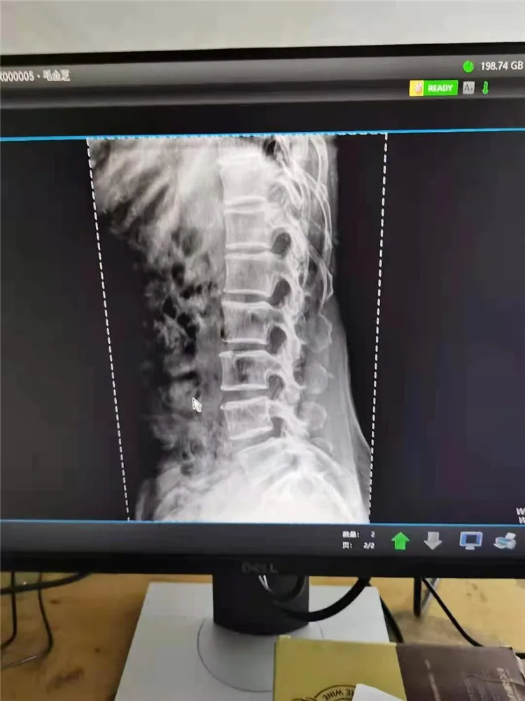 BT-XS20 hospital x ray equipment 5kw 8 inches medical mobile human digital portable veterinary x ray machine prices