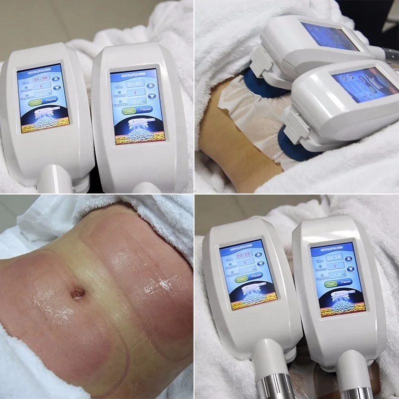  Аппарат для криотерапии 360 cryo body аппарат похудения с 4 ручками
