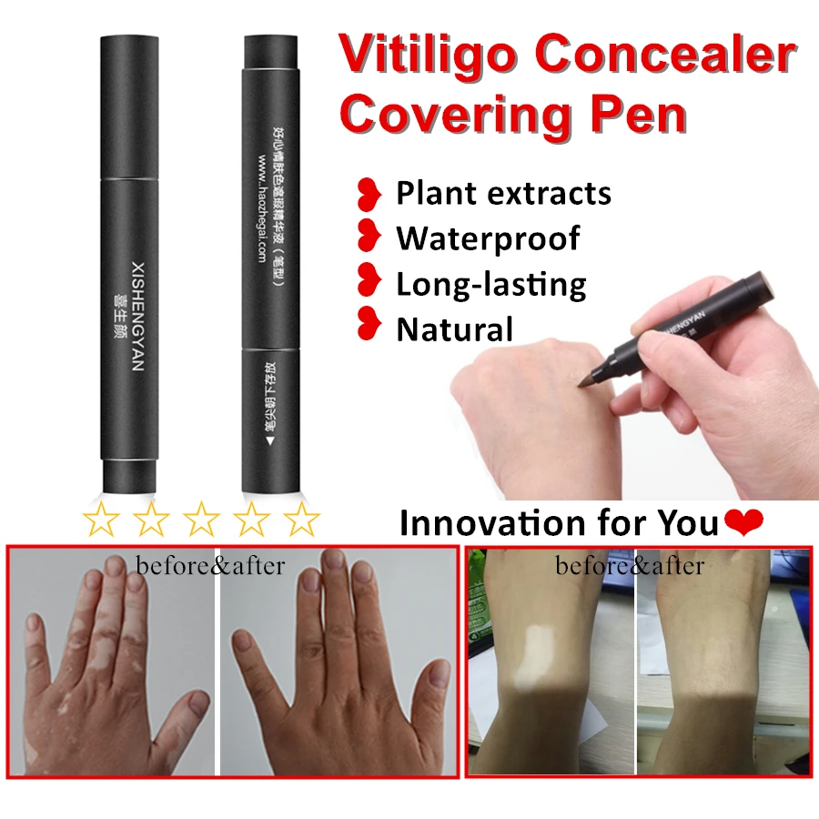 Women Men Face Discolored Skin Vitiligo Patches Makeup Vitiligo Leukoderma Covering  Waterproof Concealer Cream