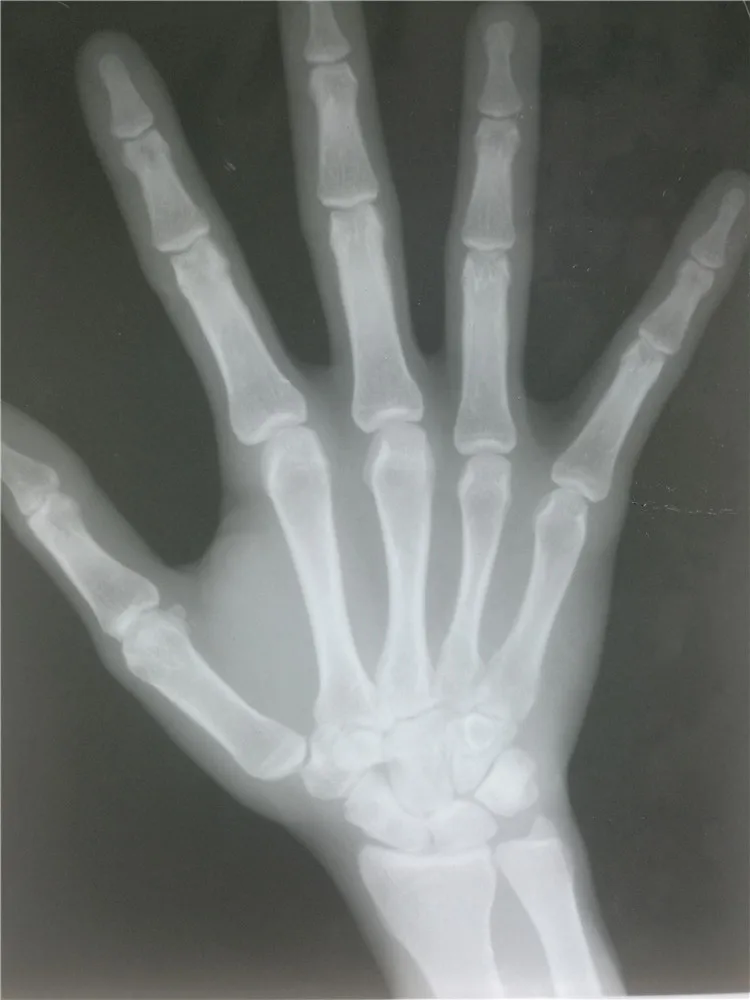 BT-XS20 hospital x ray equipment 5kw 8 inches medical mobile human digital portable veterinary x ray machine prices