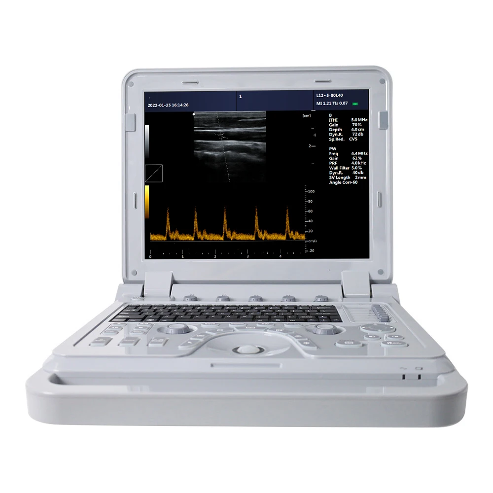 CMS600P2PLUS-VET портативный ультразвуковой цветной доплеровский