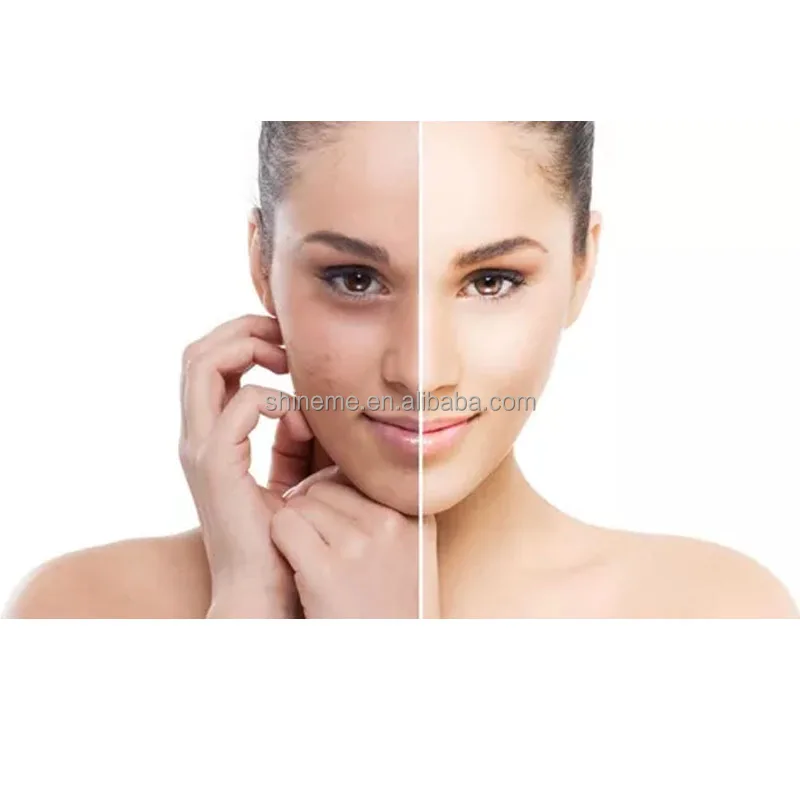 OEM Peeling Solution Deep Cleansing Skin Enzymatic and AHAS Peeling Instant Enzymatic Bio-active Peel Mask