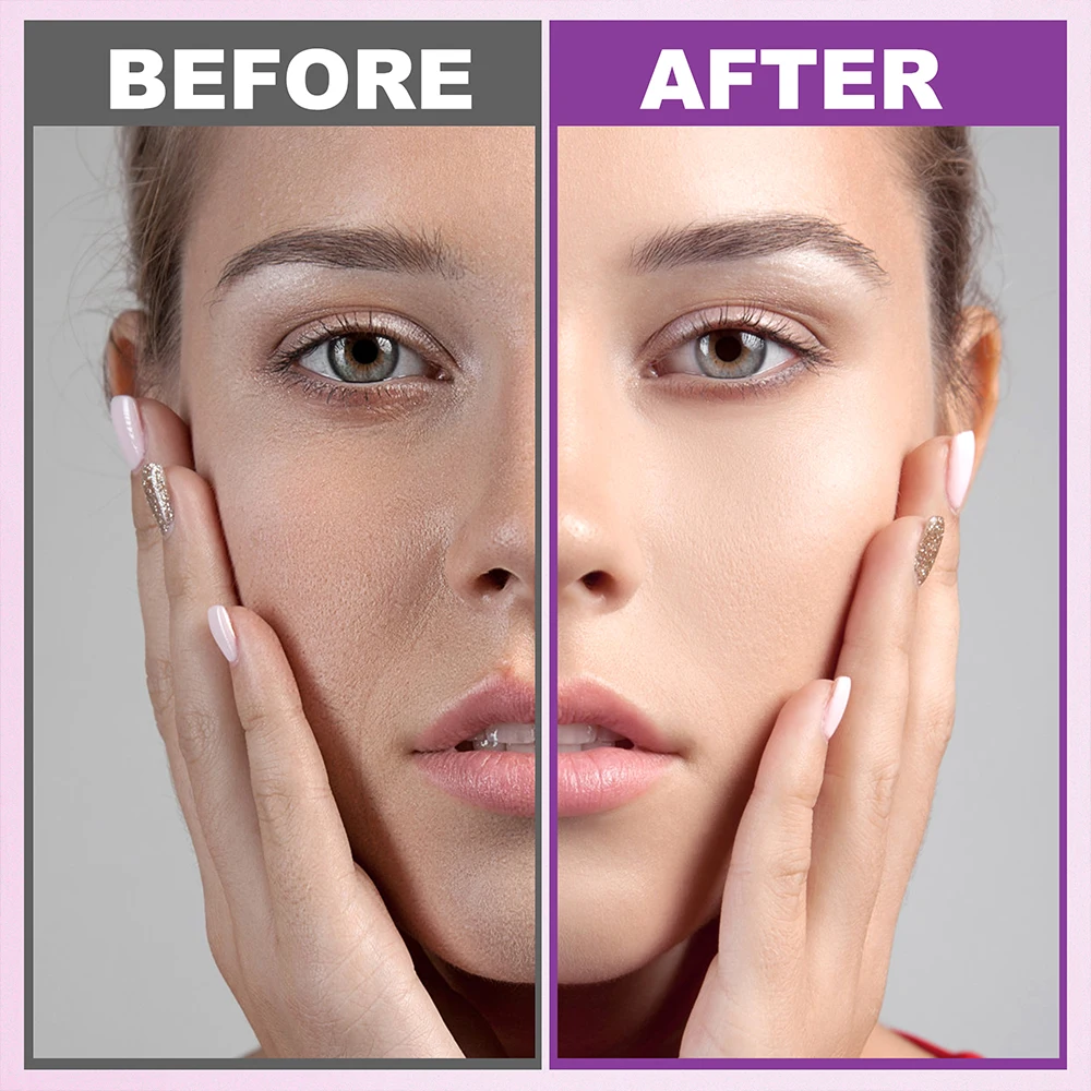 Custom Women Skin Care Set Anti Aging Hyaluronic Acid Skincare Kit Organic Korean Facial Cream Cleanser Kit For Women