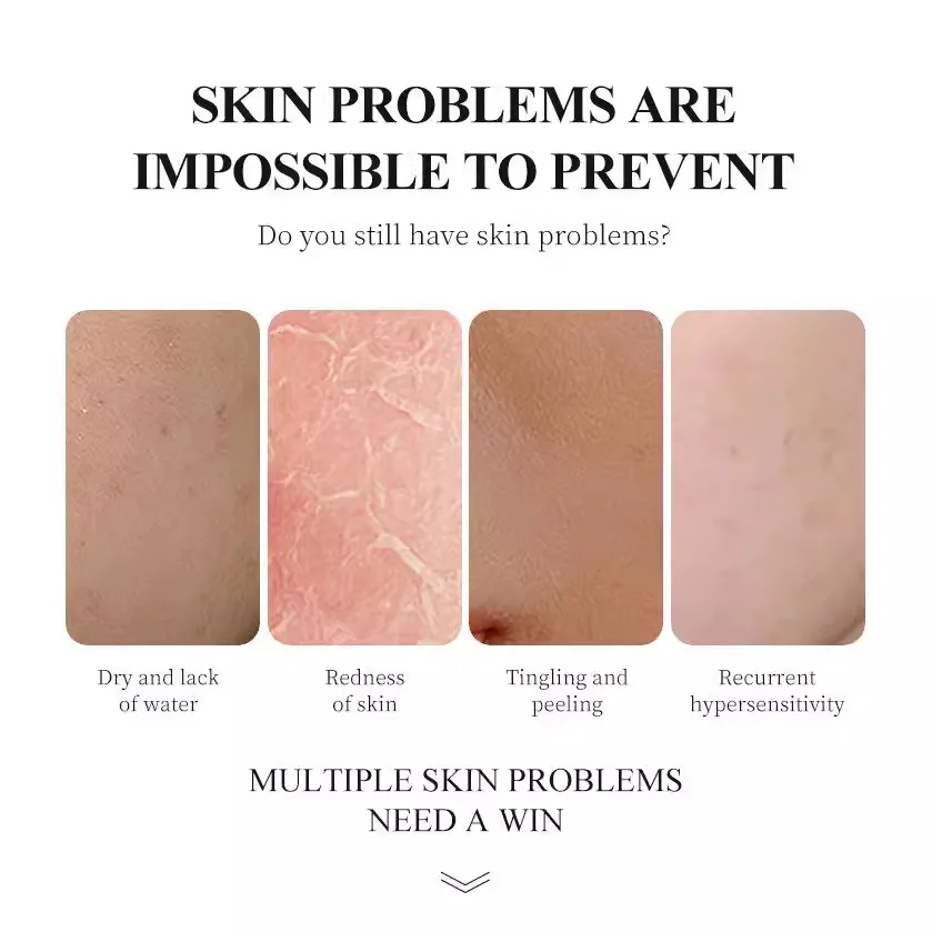 Snail  Essence care skin care set improve skin quality Face cream Eye mask Essence Water cleansing gel wholesale Customization