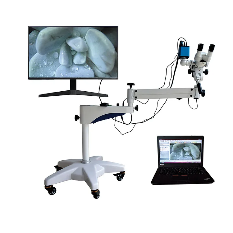 Colposcope High Resolution Colposcope Video Camera Optical Lens Binocular Vision