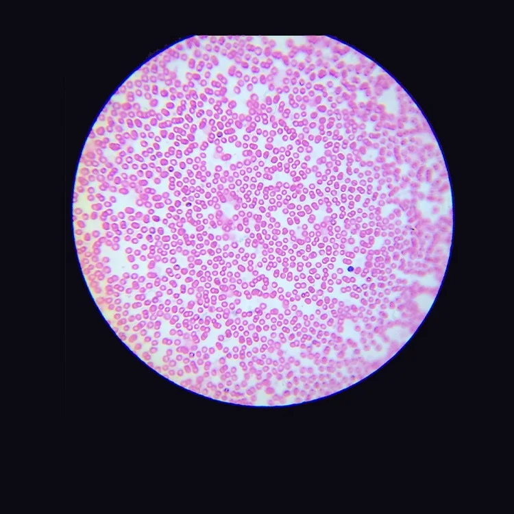 XJX-4XB professional industrial optical light quadruple digital inverted metallurgical microscope with filter for industry