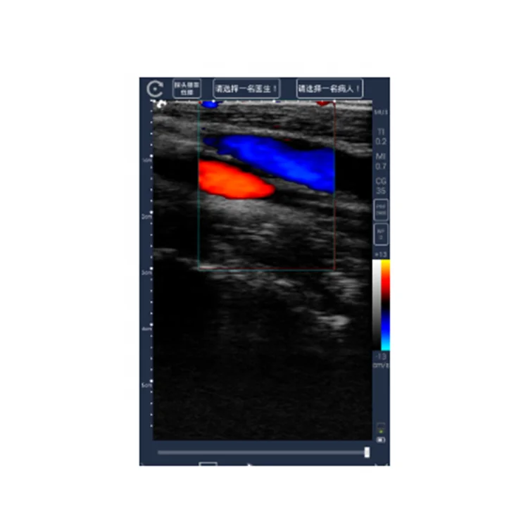 Healson Medical Ultrasound Machine With Color Doppler Usg